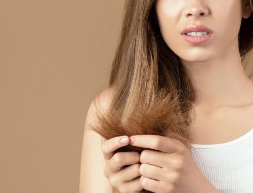 How to Repair Dry Winter Hair With Simple At Home Tricks